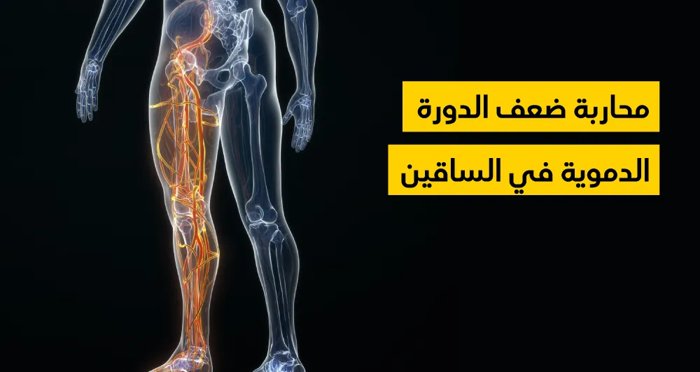 محاربة ضعف الدورة الدموية في الساقين